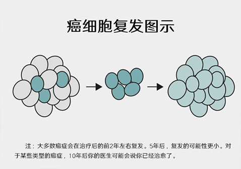 癌症治好5年后仍有复发的可能