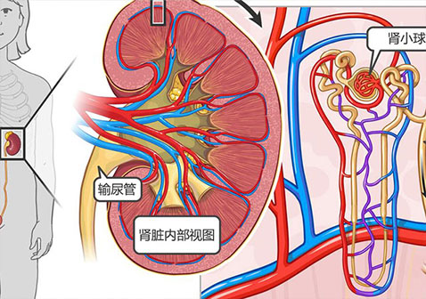 感染后的肾小球肾炎的症状和体征迹象治疗后能痊愈吗？