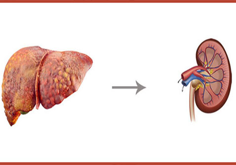 肝肾综合征是一种肾衰竭：原因，症状，治疗