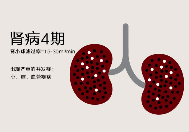 肾病4期有多严重