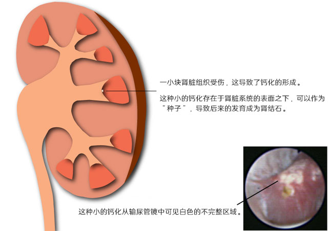 早期的成长阶段也就是晶体形成期