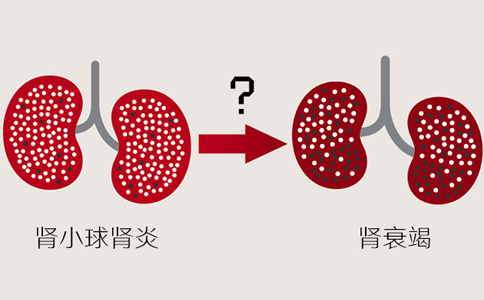 儿童慢性肾小球肾炎到肾衰需要多久？