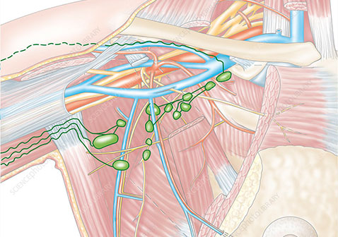 腋窝淋巴结图片